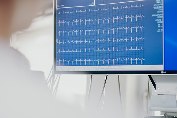 Bildschirm mit einer EKG-Darstellung. Bildschirm mit einer EKG-Darstellung.